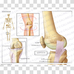 إعادة بناء الرباط الصليبي الأمامي جراحة الركبة الرضفة عظم الفخذ Png